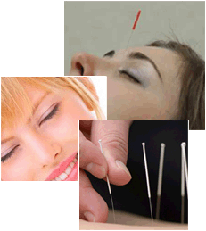 Prix acupuncture